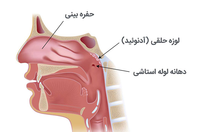 اختلال شیپور استاش