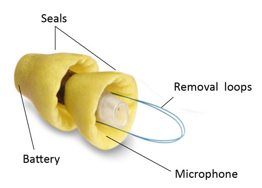 سمعک لیریک Lyric Hearing Aid