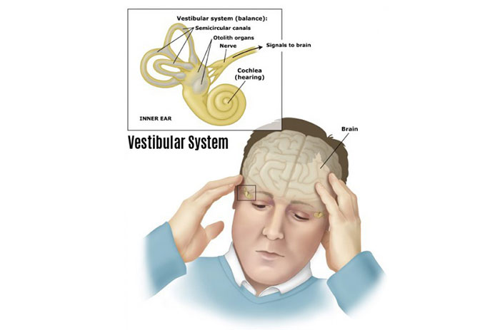 اختلالات سیستم وستیبولار گوش