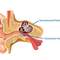 کم شنوایی حسی عصبی چیست؛ علل و علائم و درمان